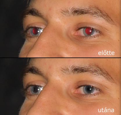 Hatékony módszerek a vörösszem effekt eltávolítására Photoshopban