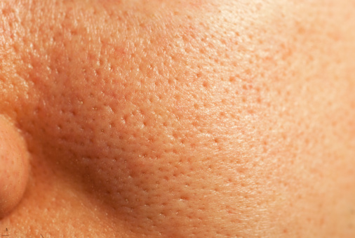 02-body-oily-skin-152951254