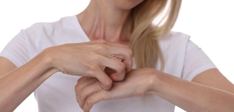 Allergische Hautreaktionen: Symptome, Ursachen und wie man sie erkennt