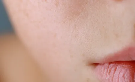 article_dehydrated-skin_1920x1080.jpg