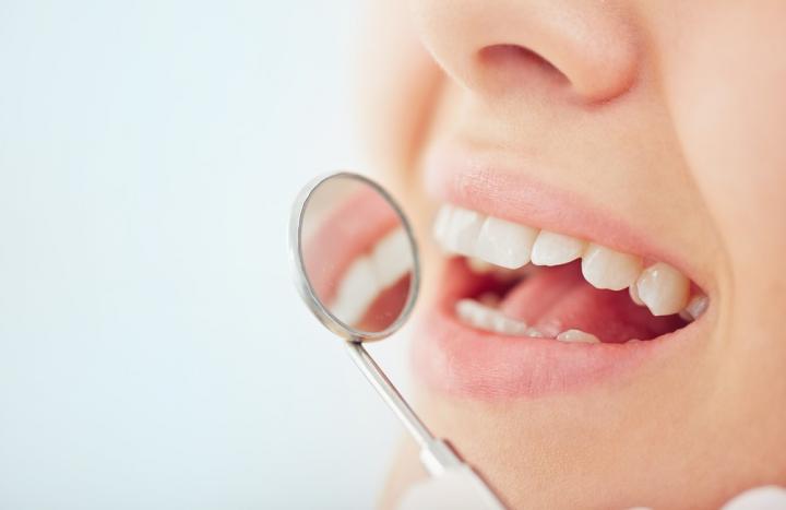 healthy-teeth-77uj9dj