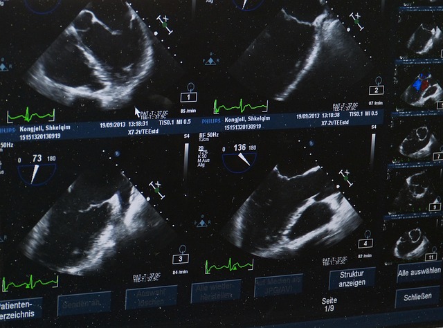 ultrasound-509396_640