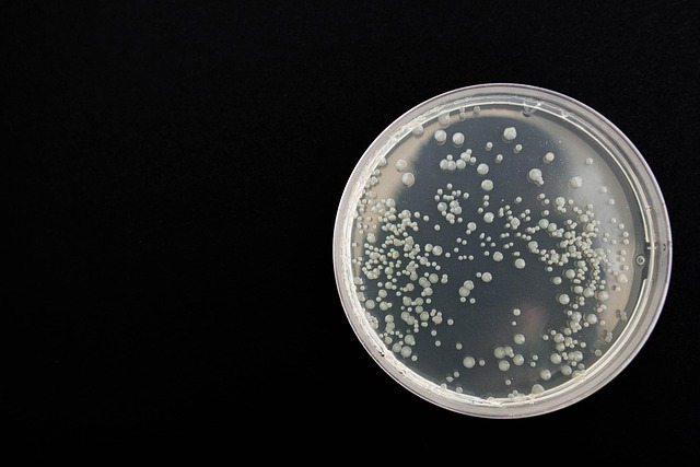 bacteria-359956_640