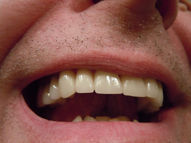 teeth-414489_640