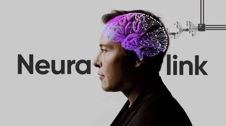 Két évtizedes bénultság után újra ír egy nő a Neuralink segítségével